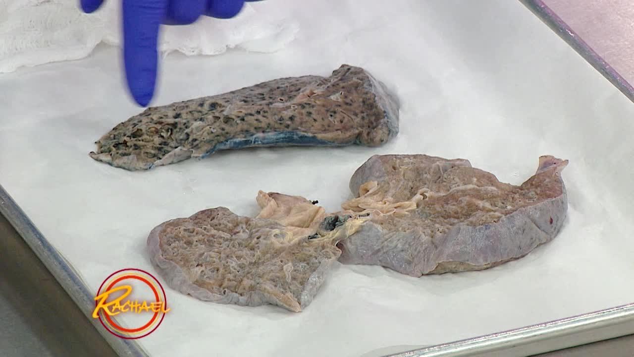 Here’s the Reality of How Smoking Affects Your Lungs… and It’s Not Pretty | Rachael Ray Show