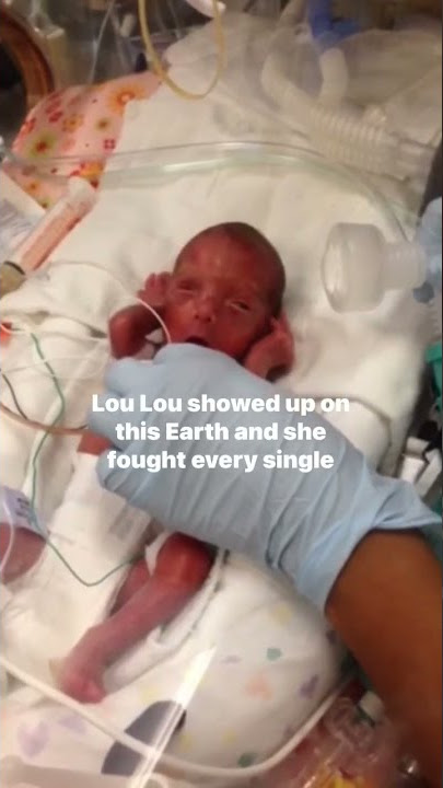 How to Support #Prematurity Awareness #nicu #nicubaby