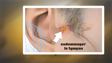 Pourquoi mon bouchon d'oreille ne part pas