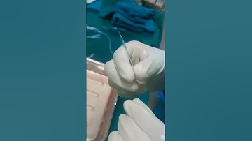 Operation theatre best whatsapp status video!! #doctorlife #mbbsdoctor #doctorpatient #doctor