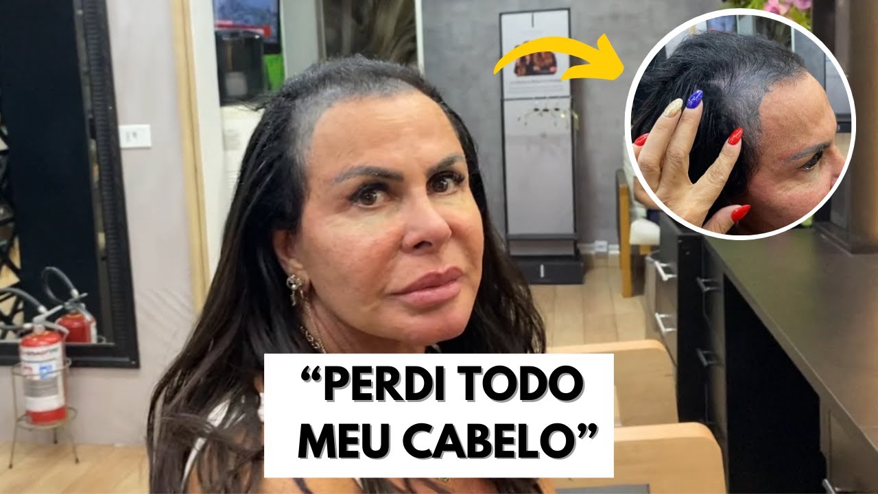 Tudo sobre a queda de cabelo da Gretchen | VEJA A TRASFORMAÇÃO! | VÍDEO COMPLETO