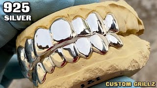 Real Solid 925 Sterling Silver Custom Fitted Grillz Set 8 on 8 Teeth