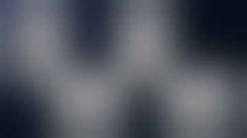 A Superficial Temporal Artery to Middle Cerebral Artery Bypass for Moyamoya Disease