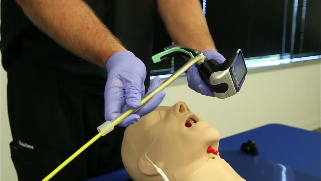 Rüsch® Airtraq™ Video Laryngoscope System ETT Insertion Using Bougie