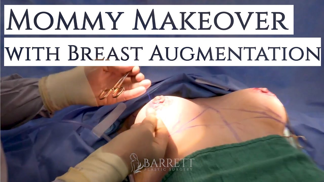 Mommy Makeover with Breast Augmentation | Dr. Daniel Barrett | Plastic Surgery | Beverly Hills