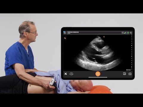 Image of Assessing LV Function
