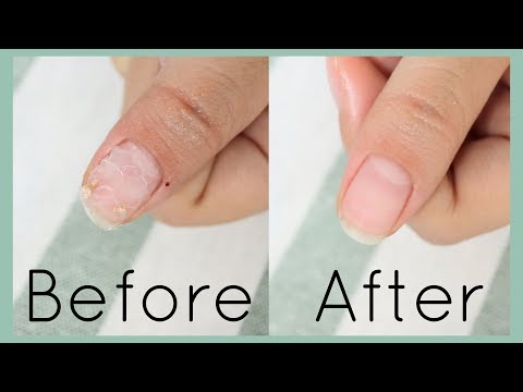 Gel nail remover at home | ล้างเล็บเจลด้วยตัวเอง ง่ายๆที่บ้าน ไม่ง้อร้าน
