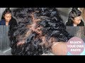 BLEACH KNOTS ON A FULL LACE WIG TUTORIAL | WIG ENCOUNTERS