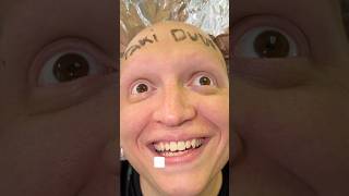 Takis Bag Bit Me PT6 #funny #comedy #relatable #skit #humor