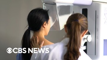 Doctor answers breast cancer questions about screenings, treatments