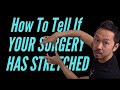 "How To Tell If You've Stretched Out Your Surgery": Dr. V Real Talk