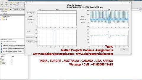 PPG and ECG analysis | PPG Signal | www.matlabprojectscode.com | www.phdresearchlabs.com