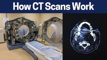 Demystifying CT Scan: How it Works in Simple Terms
