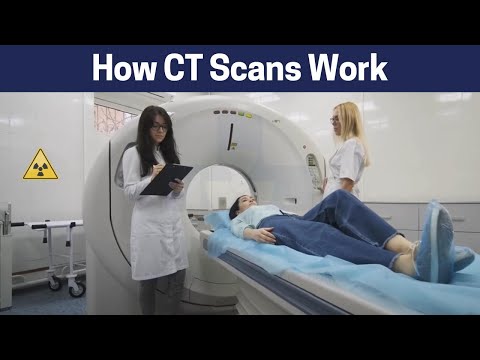 Video: Ano ang artifact sa CT scan?