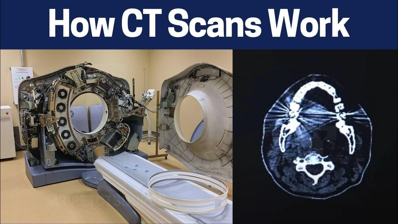 Is a CT scan Safe? Principles in Radiology Tomography) YouTube