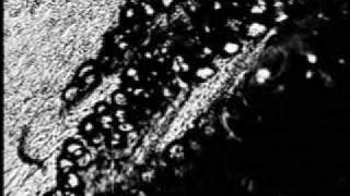 Rat Mesenteric Lymphatic 120409.Flv