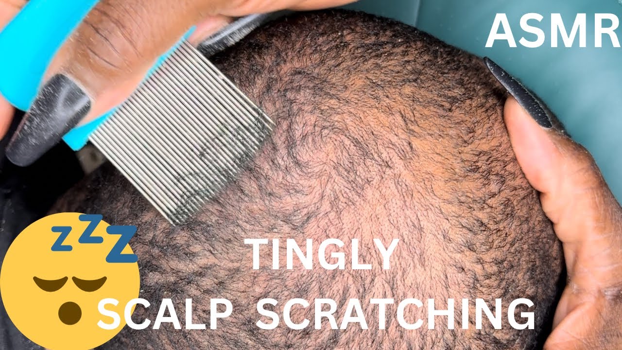 ASMR✨Tingly Scalp Scratching for Dandruff #asmr #couple #satisfying
