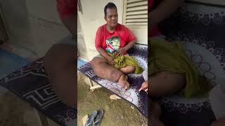 Penyakit Kaki  Gajah (Filariasis)  #penyakit #filariasis #shortvideo #kesehatan  #aceh 