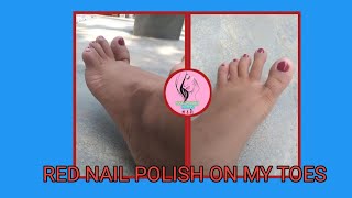 Red Nailpolish On My Toes Wearing Red Nailpolish Short Toe Nails Nailpolish Queen
