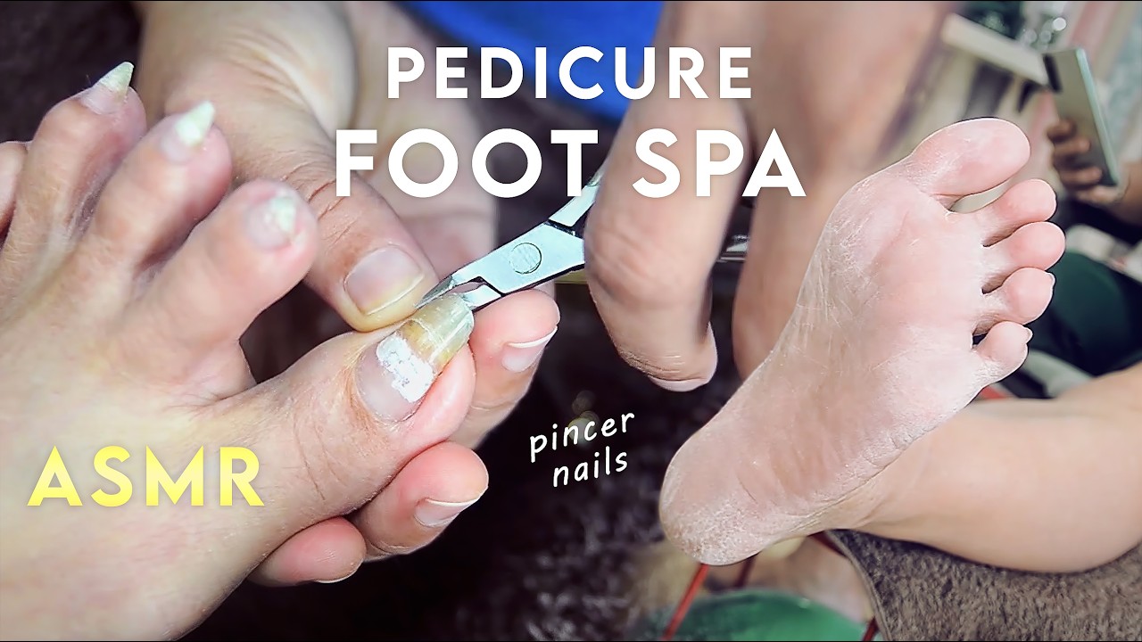 ASMR Pedicure | Long Toenails Receive a Satisfying Foot Spa Treatment ...