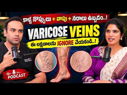 కాళ్ళ నొప్పులు + వాపు + నరాలు ఉబ్బడం | VARICOSE VEINS Symptoms ని IGNORE చేయకండి! | Dr. Arjun Reddy