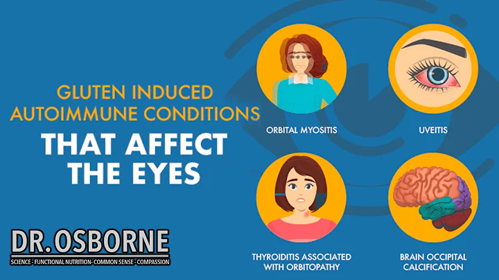 Gluten induced autoimmune diseases that affect the eyes
