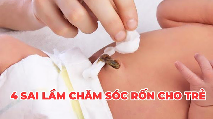 Chăm sóc rốn trẻ sơ sinh như thế nào năm 2024