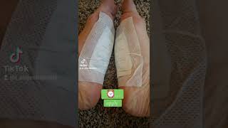 detox foot pads- 🔗 in bio #detox #detoxfootpads #ifounditonamazon