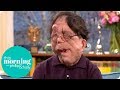 Adam pearson on changing perceptions of disfigurement  this morning