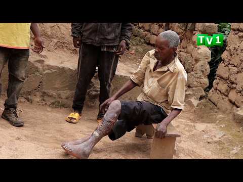 Gicumbi Umusaza W Imyaka 70 Yarwaye Igisebe Akaba Arembeye Mu Rugo 