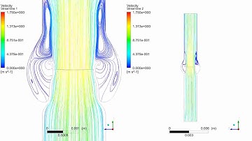 Blood flow streamlines in a 2D aortic valve.