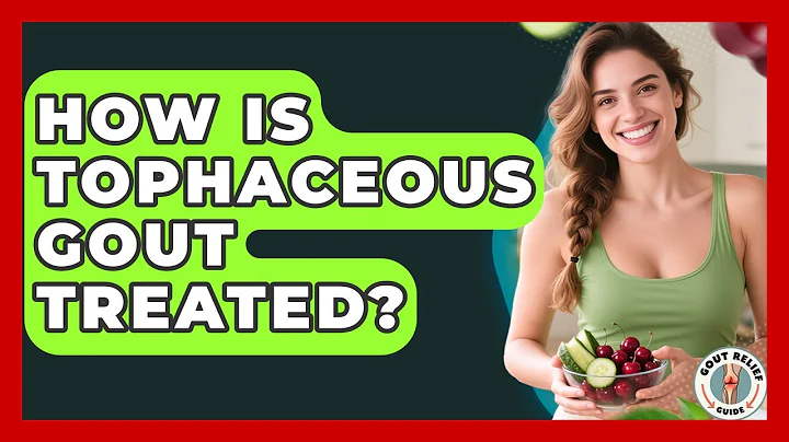 How Is Tophaceous Gout Treated? - Gout Relief Guide