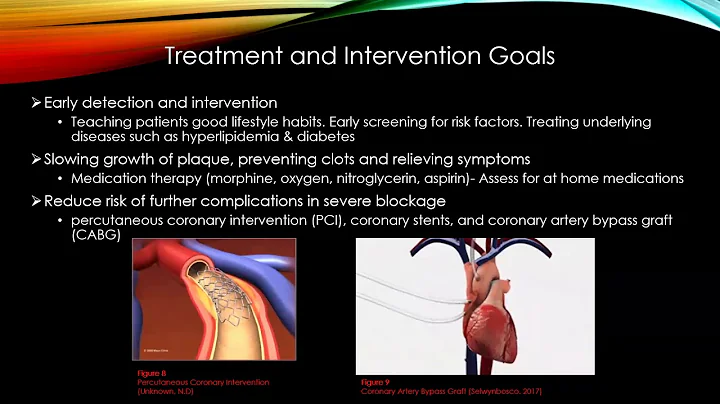 Coronary Artery Disease (CAD) Presentation