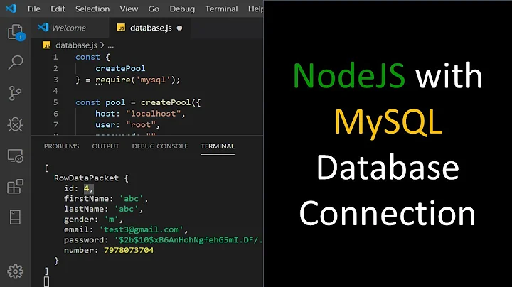 MySQL Database connection from node js application