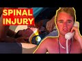 Spinal Injury - Will He Walk Again?