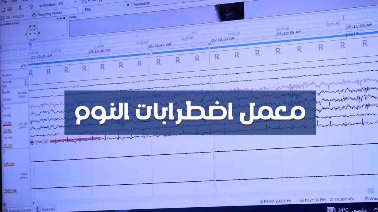 معمل اضطرابات النوم | برنامج العلاج التنفسي