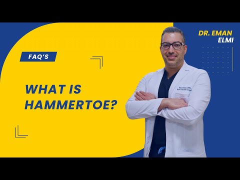What is Hammertoe? video thumbnail