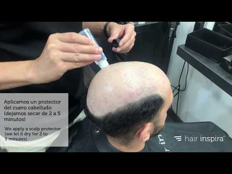 Tutorial #7: Pasos aplicación prótesis capilar / Steps to apply a hair system - Hair Inspira
