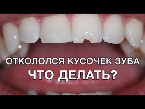 Что делать если откололся кусок зуба?