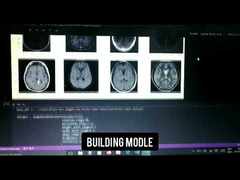 Brain tumor classification using CNN network