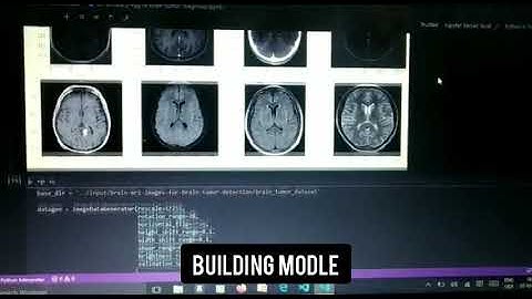 Brain tumor classification using CNN network