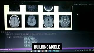 Brain tumor classification using CNN network