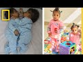 Conjoined Twins Separated | National Geographic