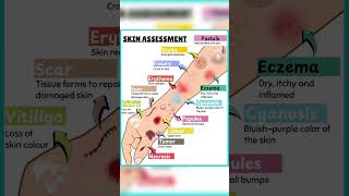 Skin Assessment Explained | 12 Common Skin Lesions with Examples #shorts