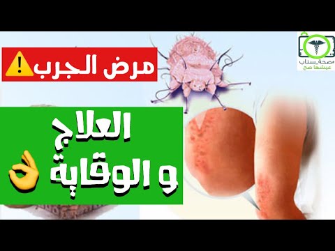 فيديو: السيطرة على الحفرة المرة: علامات مرض حفرة التفاح المرة وكيفية علاجه