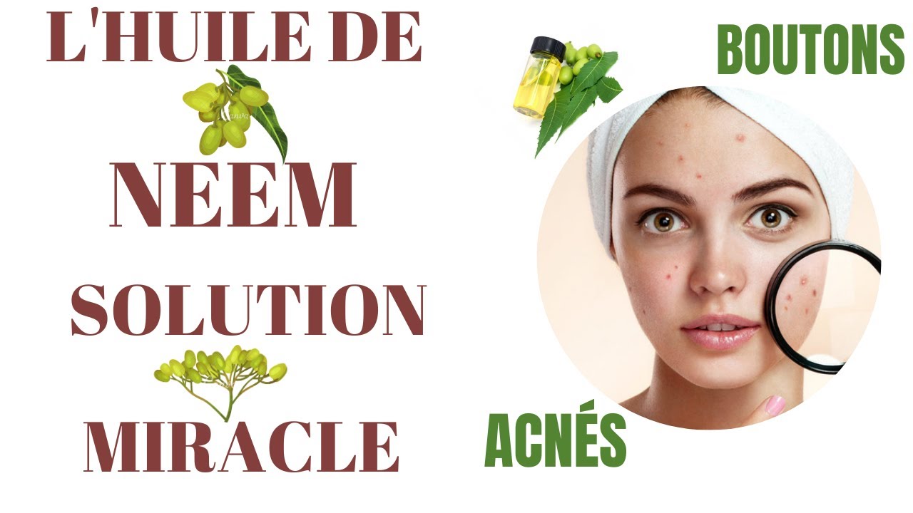 Se débarrasser des boutons d'acnés rapidement et naturellement. - YouTube