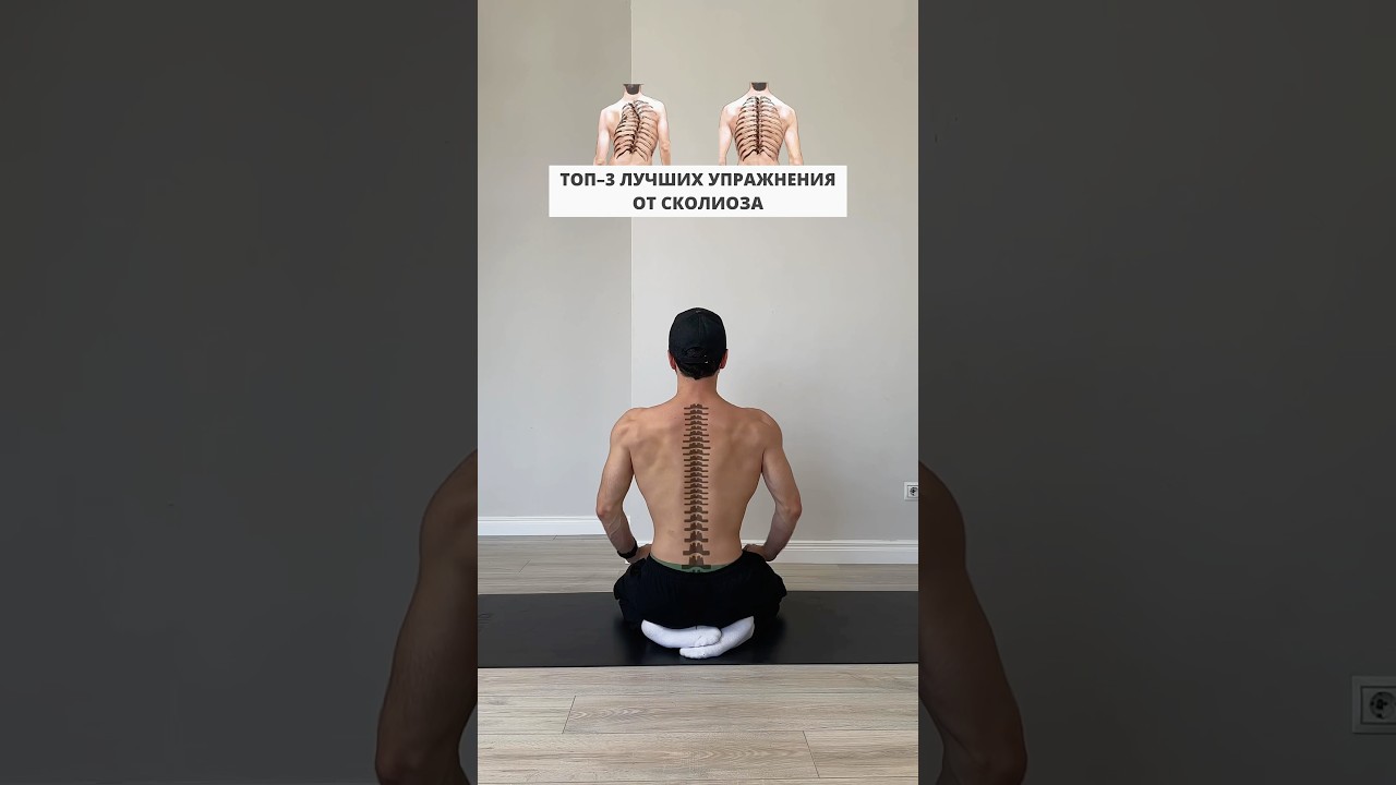 ТОП-3 упражнения от сколиоза! 🧘♂️