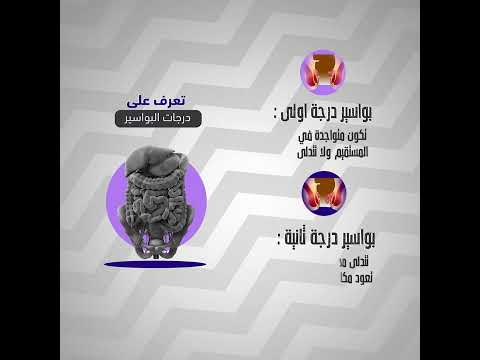 مراحل تطور البواسير الأربعة