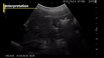 Esophagus, Stomach, Duodenum Dog Ultrasonound Examination