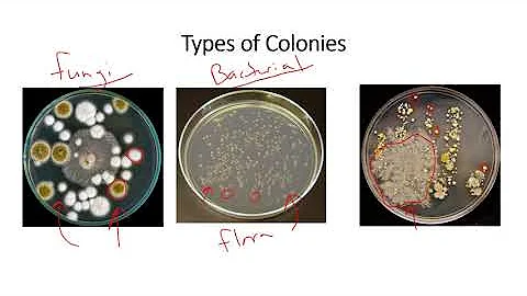 Lab 1  Ubiquity of Microbes